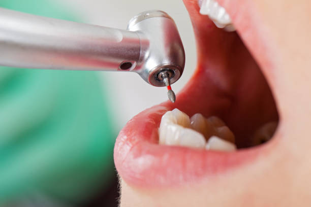 Best Emergency Broken Tooth Repair in Salado, TX